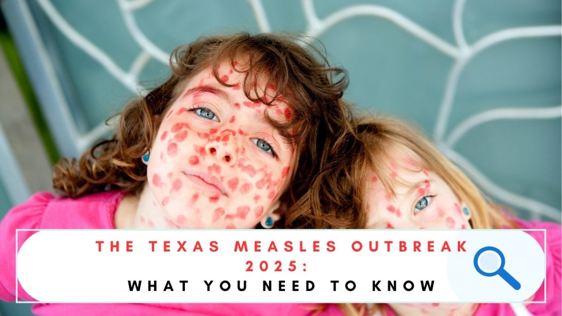 Texas Measles Outbreak 2025