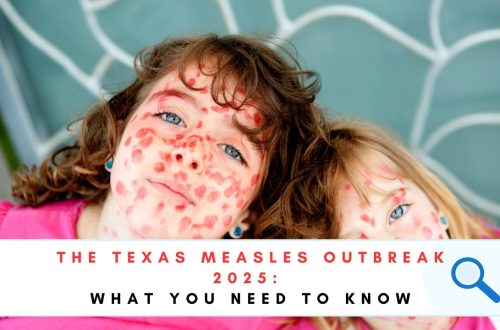 Texas Measles Outbreak 2025