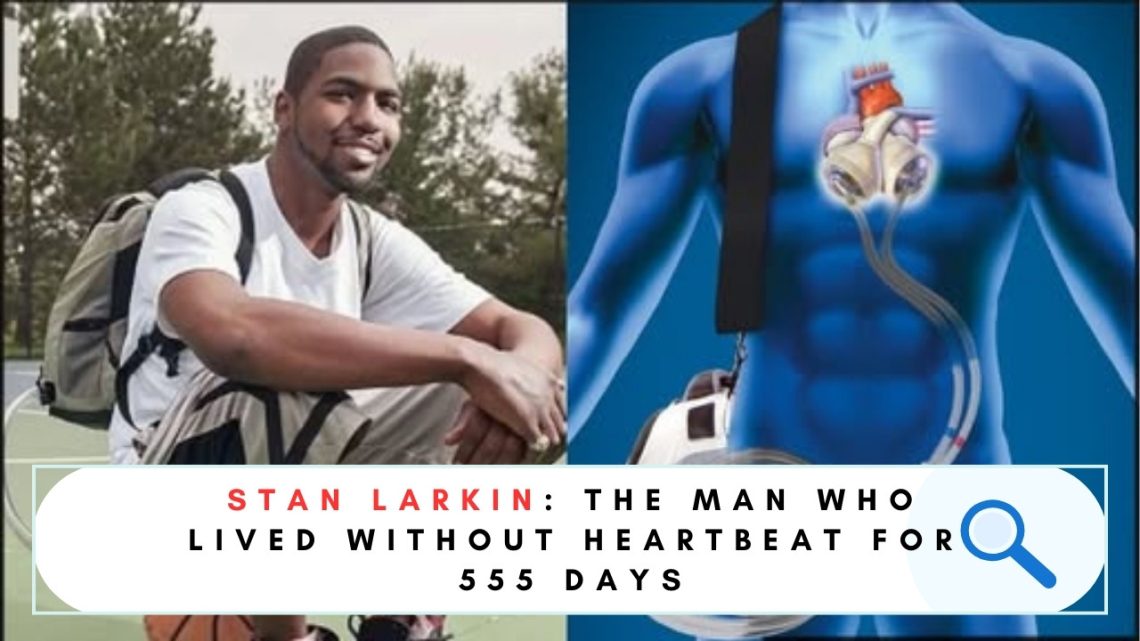 Stan Larkin Artificial Heart