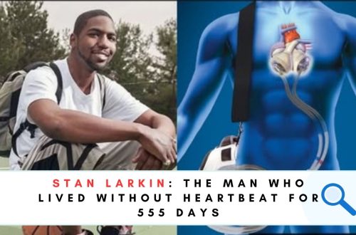 Stan Larkin Artificial Heart